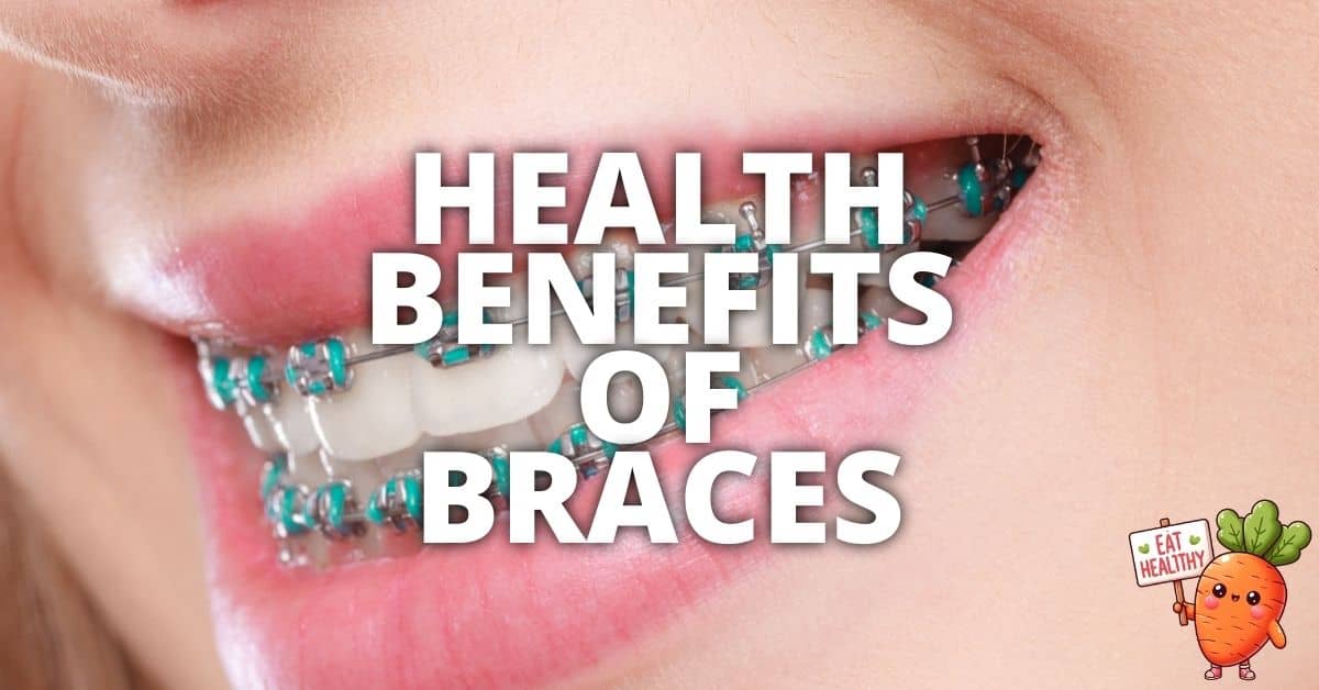Potential Health Benefits Braces